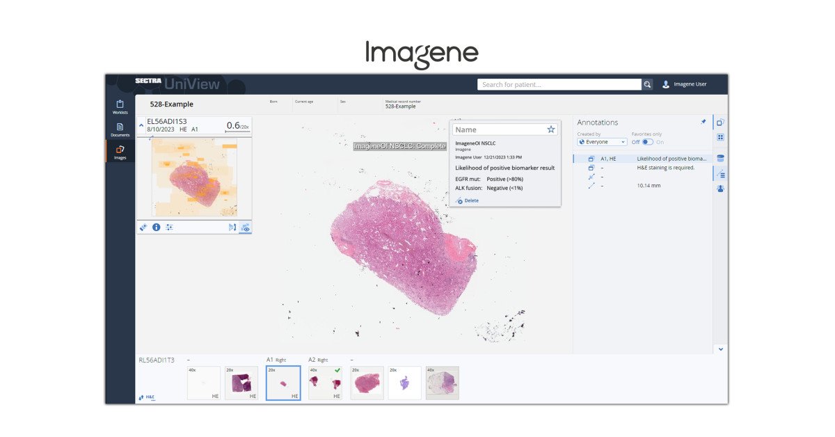 Imagene Increases Accessibility of Rapid AI-Based Biomarker Profiling Through Integration With Sectra