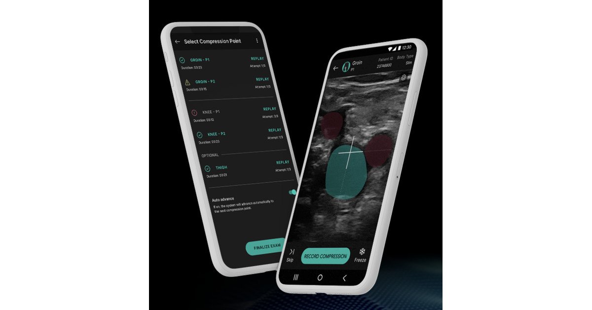 Temple Health Joins U.S. Study of Artificial Intelligence Diagnostic System for DVT Detection